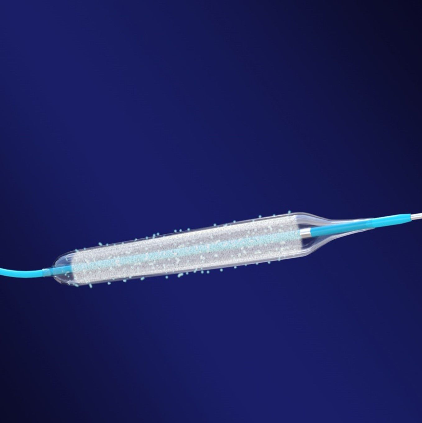 Periferik PTA Balonlar