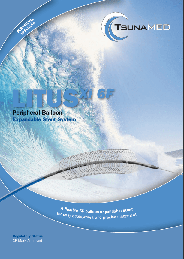 Litus Balon Expandable Stent System